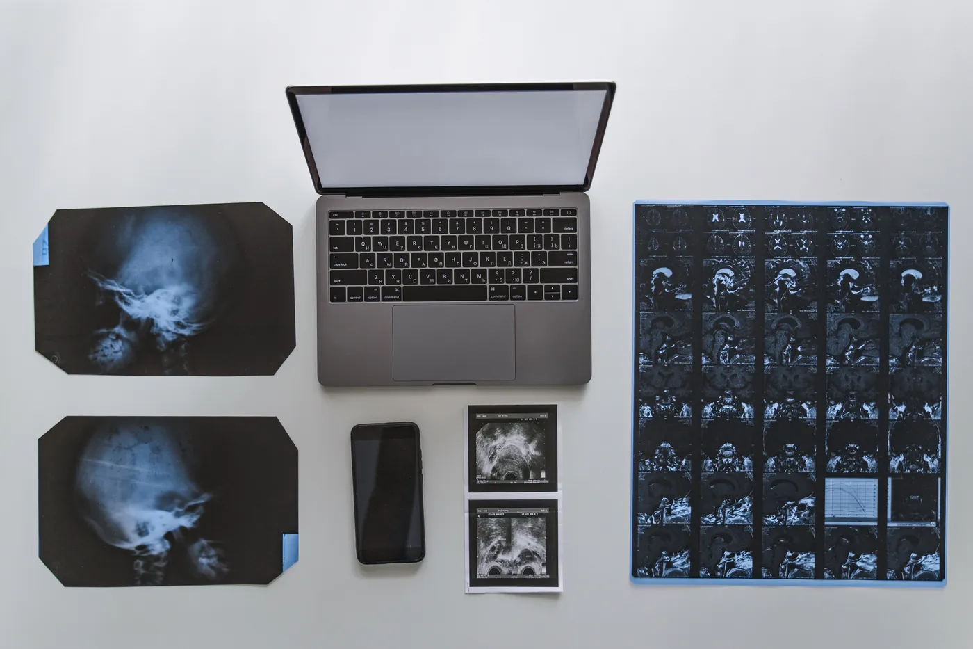 Clichés de radiographie et planches d'IRM disposés autour d'un ordinateur portable et d'un téléphone sur un bureau clair
